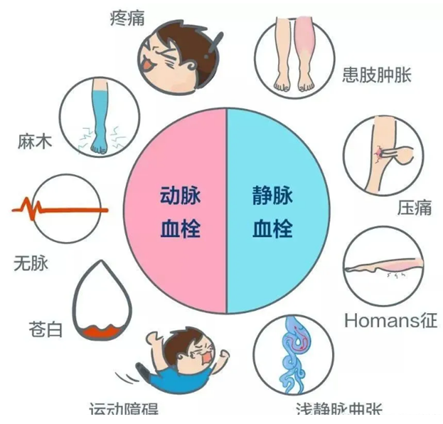 2022世界血栓日：就醫(yī)有新路，血栓找介入