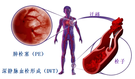 長(zhǎng)途旅行 快樂(lè)相伴 健康相隨