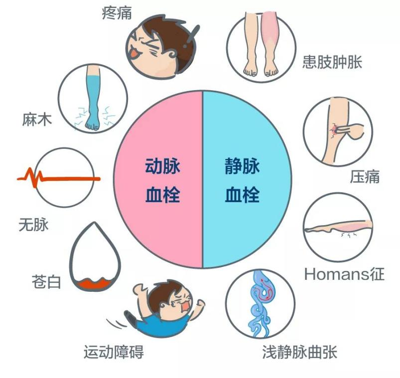 深靜脈血栓能致命，防治“大法”要了解！