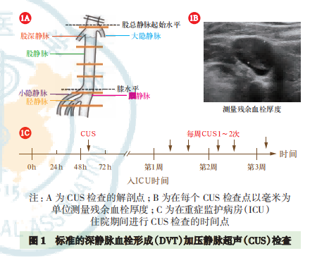 老年重癥患者靜脈血栓栓塞癥預(yù)防中國專家共識(shí)（2023）