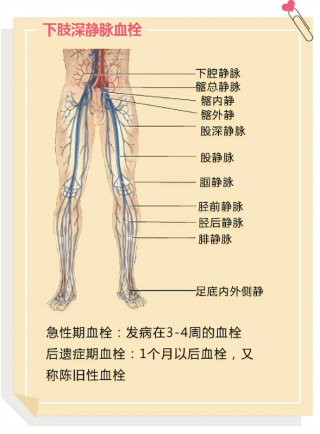 圍生期靜脈血栓栓塞癥（VTE）